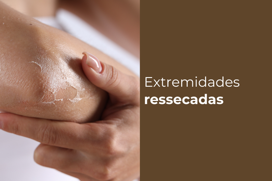 Extremidades ressecadas: por que sofrem tanto e como cuidar melhor?